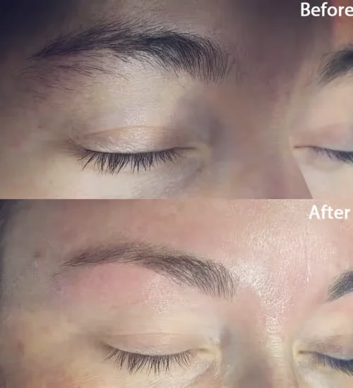 Before and after images of Eyebrow Waxing | Reflections Medspa | Lexington, KY