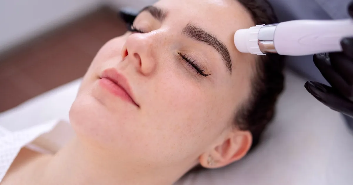 women receiving Microneedling in Lexington